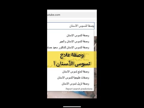 لقيتلكم أفضل وصفة لعلاج تسوس الاسنان و تبييض الاسنان في يوتيوب لا تفوتكم 