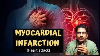 MYOCARDIAL INFARCTION (MI) | Heart attack in 20mins!