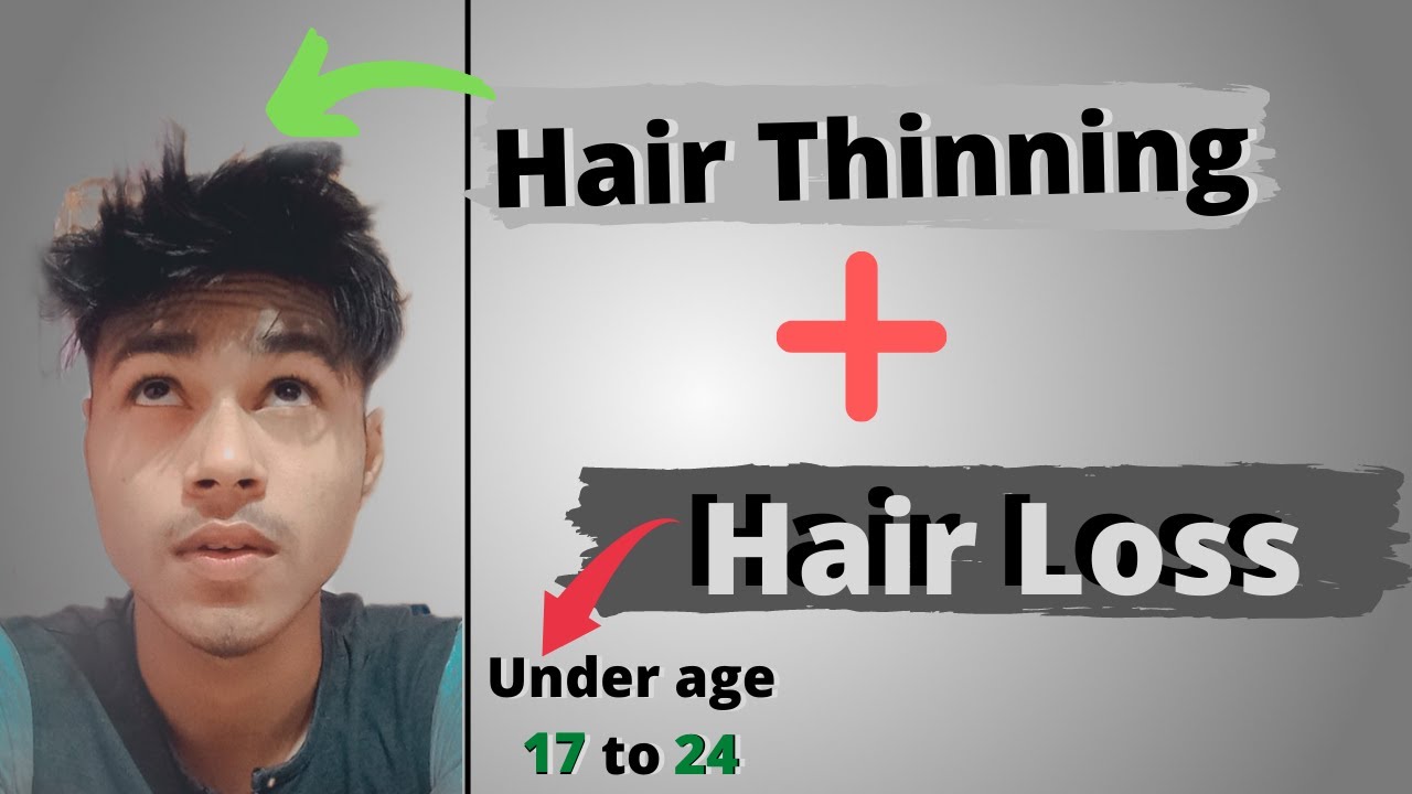 Hair Thinning and Hair loss treatment |