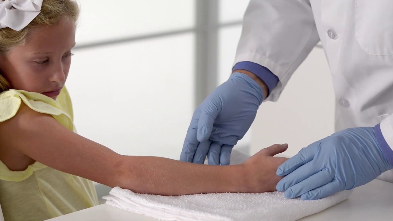 3M Thumb Spica Cast Gamut One Studios YouTube