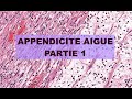 Appendicite aigue  pathologie