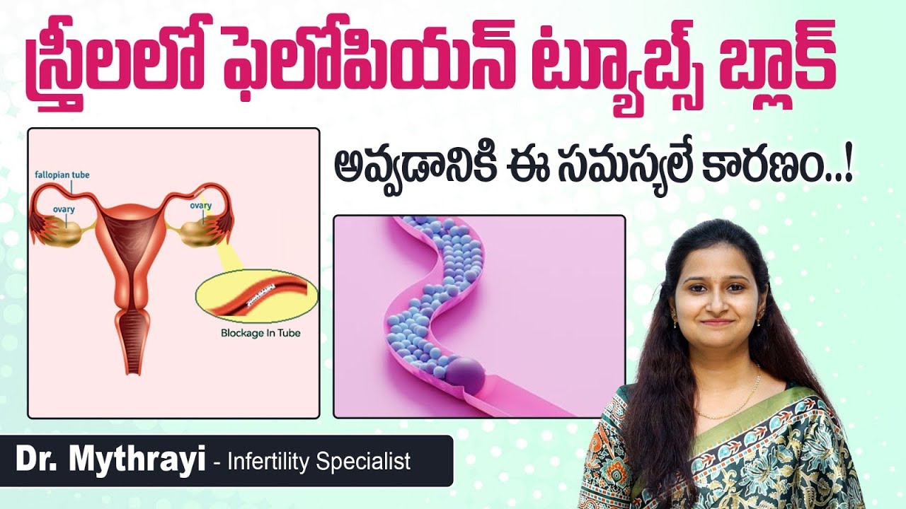 అండవాహికలు మూసుకుపోవడానికి కారణం || Causes of Fallopian Tube Blockage || Mythri Sri Fertility Centre