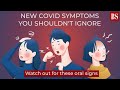 New Covid symptoms you shouldn't ignore: Watch out for these oral signs