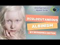 Child eye specialist in dewas | Oculocutaneous albinism