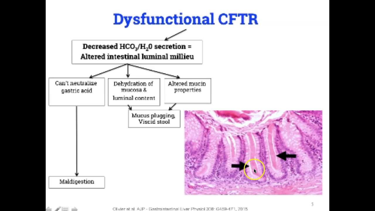 Cystic Fibrosis Gastrointestinal Manifestations, Part 1