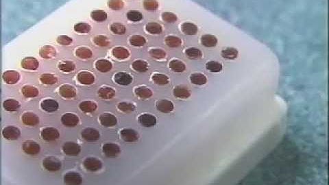 Arraymold - Paraffin Tissue Microarray  Vol.1