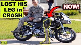 Biker Loses Leg in CRASH | Avoid Motorcycle Injuries