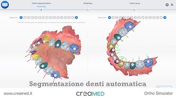 [Aoralscan 3] Modulo Ortho Simulator