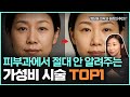 이 가격에 이정도 효과를? 수백만 원 아낄 수 있는 피부과 최고의 가성비 시술