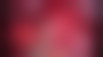 Asvide: Uniportal VATS right S2 + S3 anatomic segmentectomy