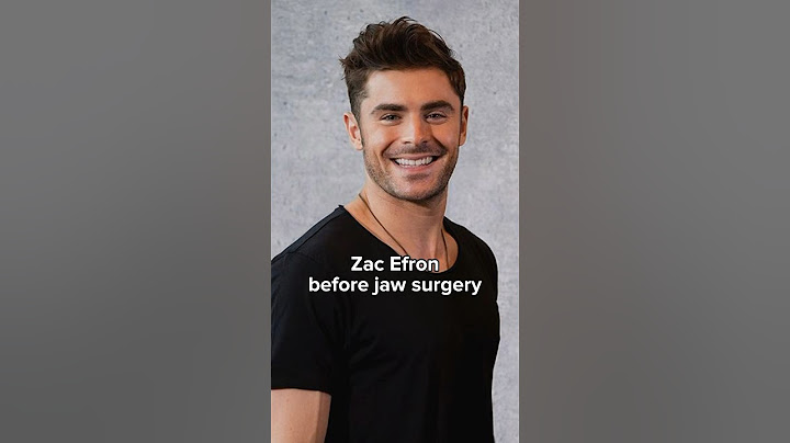 Zac Efron before and after jaw surgery #zacefron #shorts