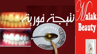 لاسنان ناصعة البياض والنتيجة من اول استخدام/مع خبيرة التجميل/ملك screenshot 5