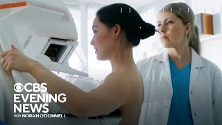 New mammogram guidelines say screenings should start at 40