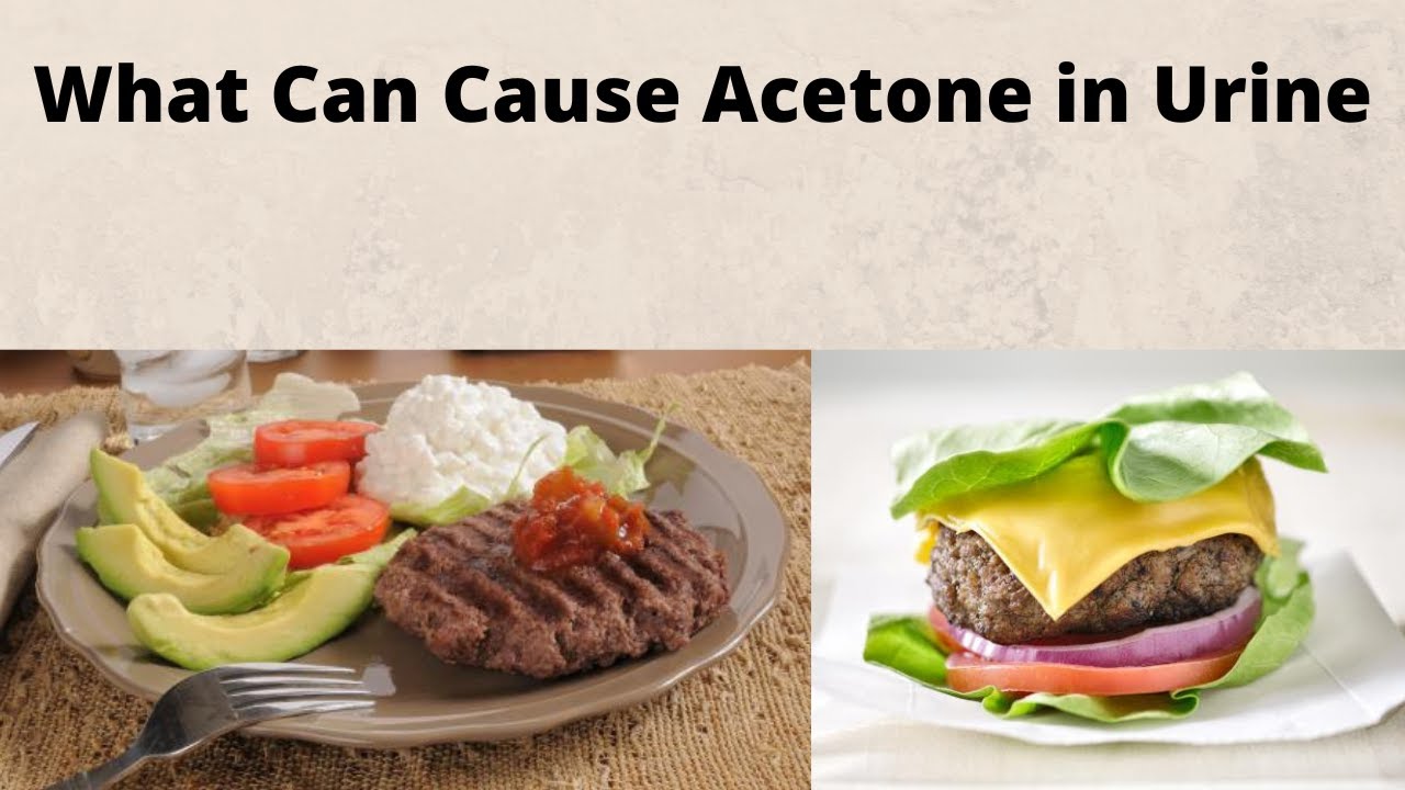 What Can Cause Acetone in Urine YouTube