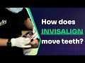 How does Invisalign move teeth? | Invisalign attachments - Step-by-Step Guide