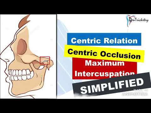 Centric Relation, Centric Occlusion u0026 Maximum Intercuspal Position (CR, CO, MIP)