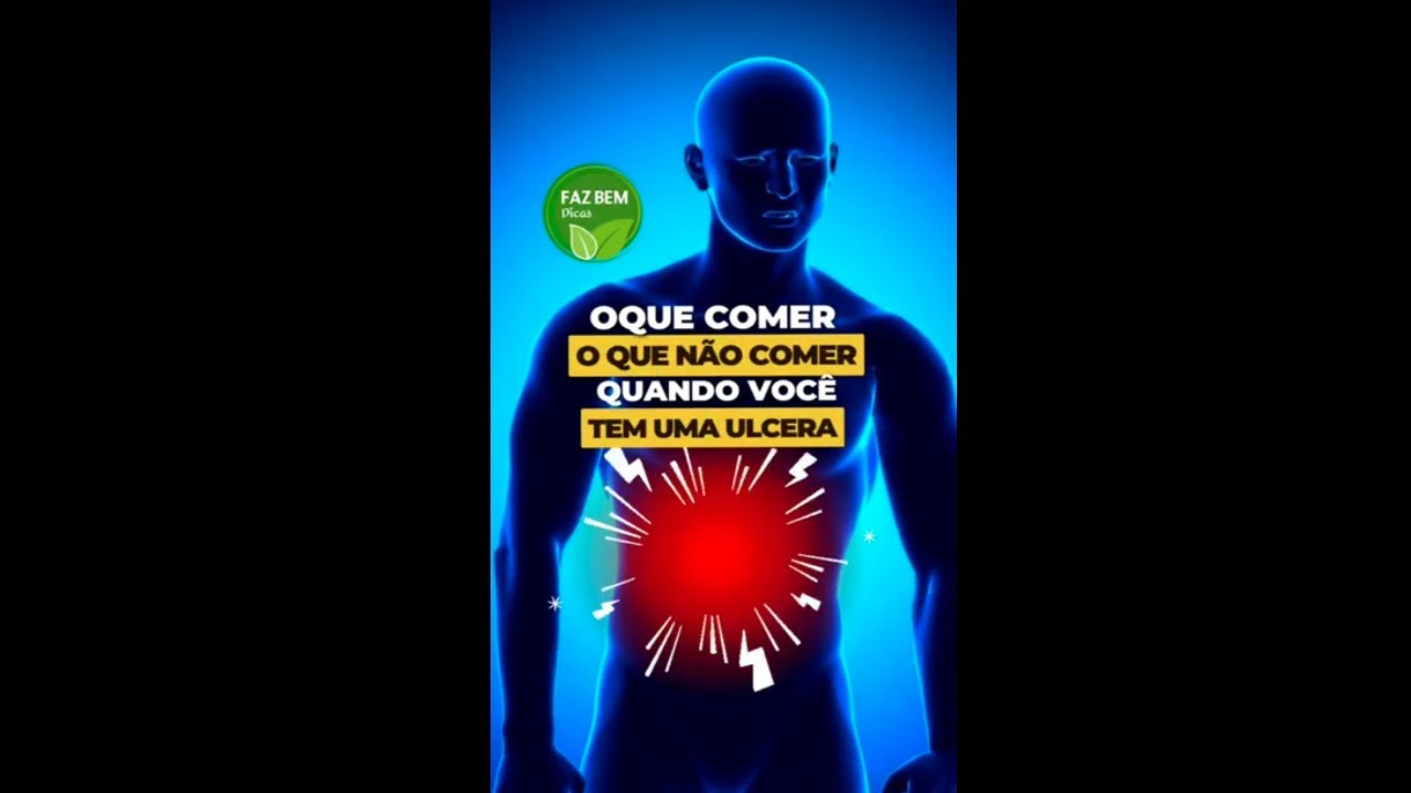 Quem Tem úlcera Pode Comer O Que - RETOEDU
