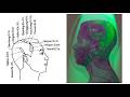 HOLOGRAPHIC THEORY IN SCALP ACUPUNCTURE (TOP QUESTIONS)