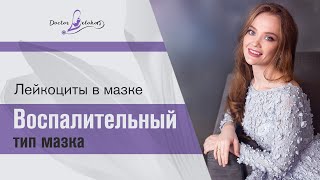 Воспалительный тип мазка. Лейкоциты в мазке