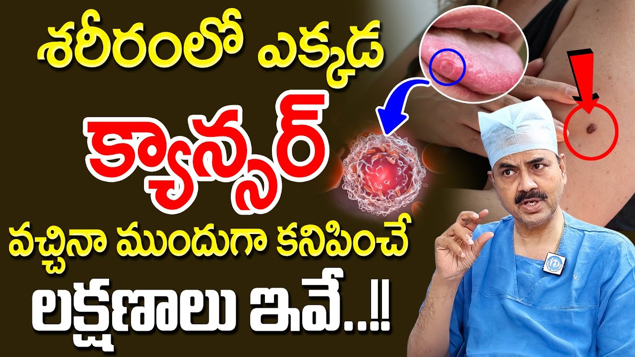 ఈ లక్షణాలు ఉంటే మీకు క్యాన్సర్ ఉన్నట్టే జాగ్రత్త..! | Cancer Symptoms |  Dr Mohan Vamshi | iDream