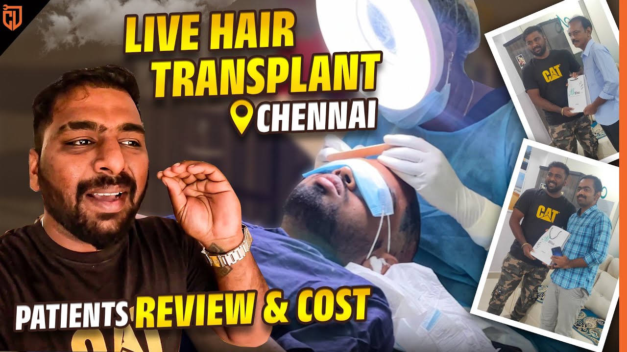 Hair transplant செய்வது இப்படிதானா😱 | இத பண்ண எவ்ளோ ஆகும்னு தெரியுமா?😳 | Cherry Vlogs