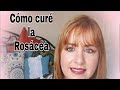 Cómo curé mí Rosácea #cincuentonasbellasyfelices