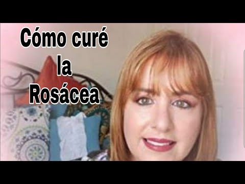 Vídeo: Cómo Usar El Aceite De Coco Para La Rosácea: Alivia Y Calma Tu Piel