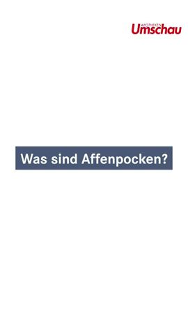 Was sind Affenpocken? (Prof. Dr. Roman Wölfel, Bundeswehr)