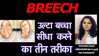 Breech Presentation | उल्टा बचा सीधा करने का तरीका