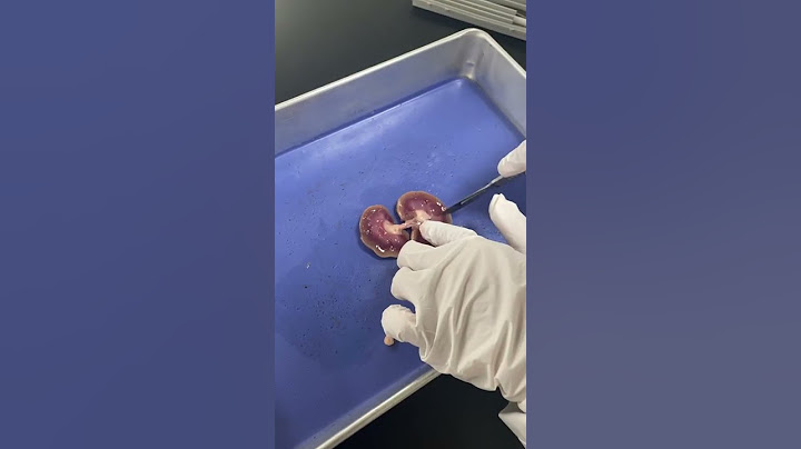 لاب اليوم تشريح الكلية (kidney dissection )،كان حلو استمتعنا 🌟#طالبة_طب #مختبرات #يوميات #تشريح