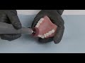 Denture workflow post processing dentures