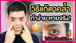 วิธีกำจัดใต้ตาดำ กำจัดรอยคล้ำใต้ตา ใต้ตาคล้ำ ลาก่อนหมีแพนด้า l นุชา HAPPY NUCHA