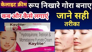 Kaylite cream review in hindi | kaylite cream ke fayde | kaylite fairness cream रूप निखारे गोरा बनाए