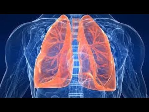 Video: 3 manieren om van bronchitis af te komen