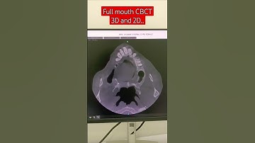 Full mouth CBCT | Scan #siemens #carestream #video #3d #2d #ctscan #mouth #dental #anatomy