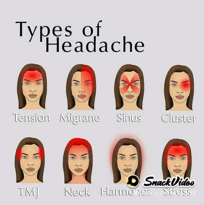 Types of Headache s(1)