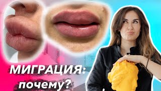 видео: Миграция филлера в губах,почему возникает и как избежать? #губы #миграцияфиллера #косметолог #филлер картинка: Миграция филлера в губах,почему возникает и как избежать? #губы #миграцияфиллера #косметолог #филлер