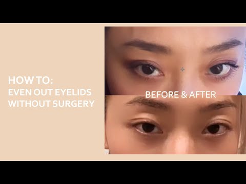 how to even out uneven eyelids (WITHOUT SURGERY)