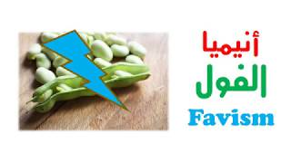 أنيميا الفول - Favism