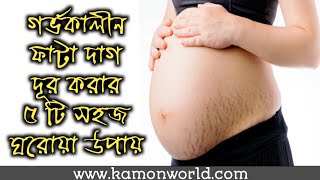 গর্ভবতী অবস্থায় ফাটা দাগ দূর করার ঘরোয়া ৫ উপায় | pregnancy stretch marks remedy bangla.