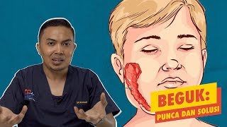 Beguk: Punca dan Solusi