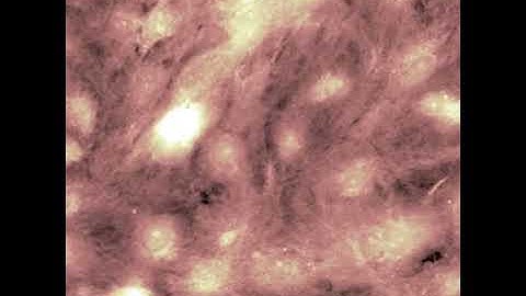 Cardiomyocytes contraction and calcium imaging