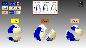 17 Segment Model - Long Axis