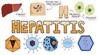 Viral Hepatitis - How Does Hepatitis Affect The Liver?  Acute vs Chronic Hepatitis