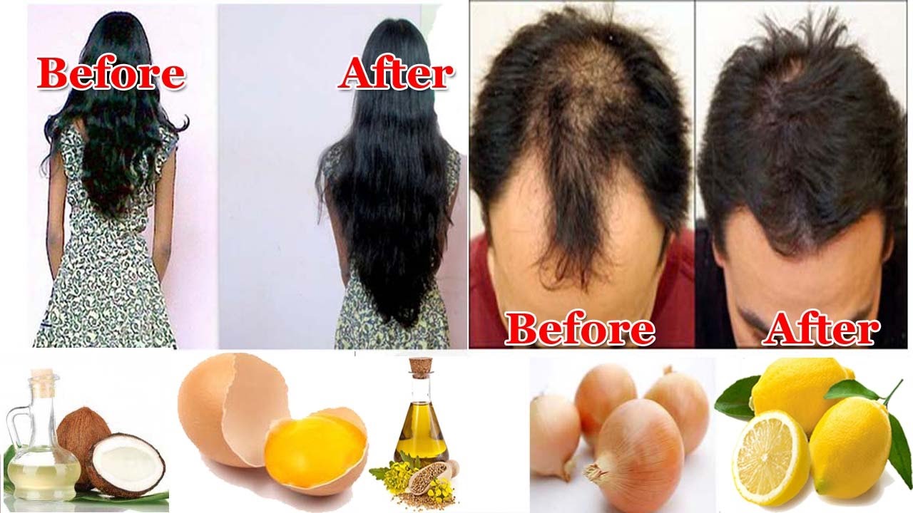 How To Make Black Hair Grow Faster And Longer Youtube