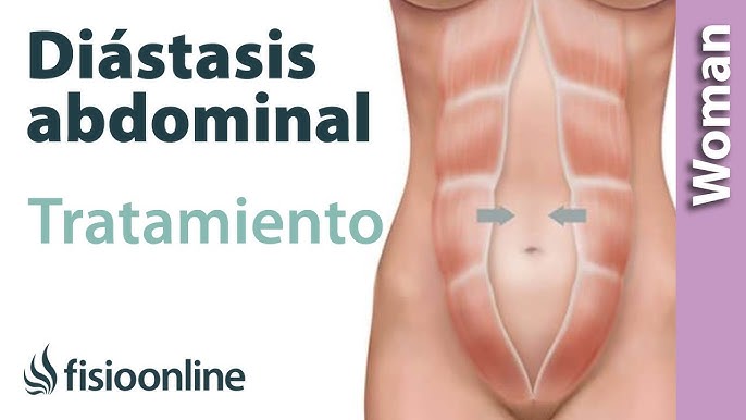 ❗ DOLOR Bajo Abdominal EMBARAZO 🤰🏼 CALAMBRES Abdomen Bajo 〽 Ligamentos  redondos [PUBALGIA] 