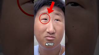 Why some people are born with tiny eyes #shorts #facts