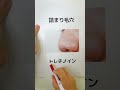【皮膚科医が教える】この肌悩みにはまずはこれ