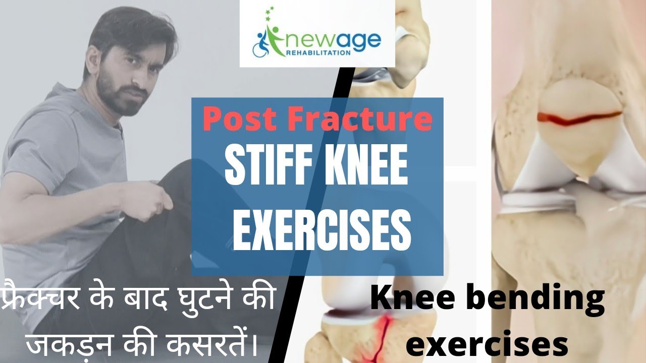 Stiff Knee Exercises/ Exercises for Post Fracture Knee Stiffness/ Knee