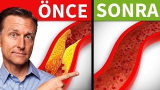 Damar Tıkanıklığına Karşı En Etkili Besinler | Dr. Berg Türkçe screenshot 4